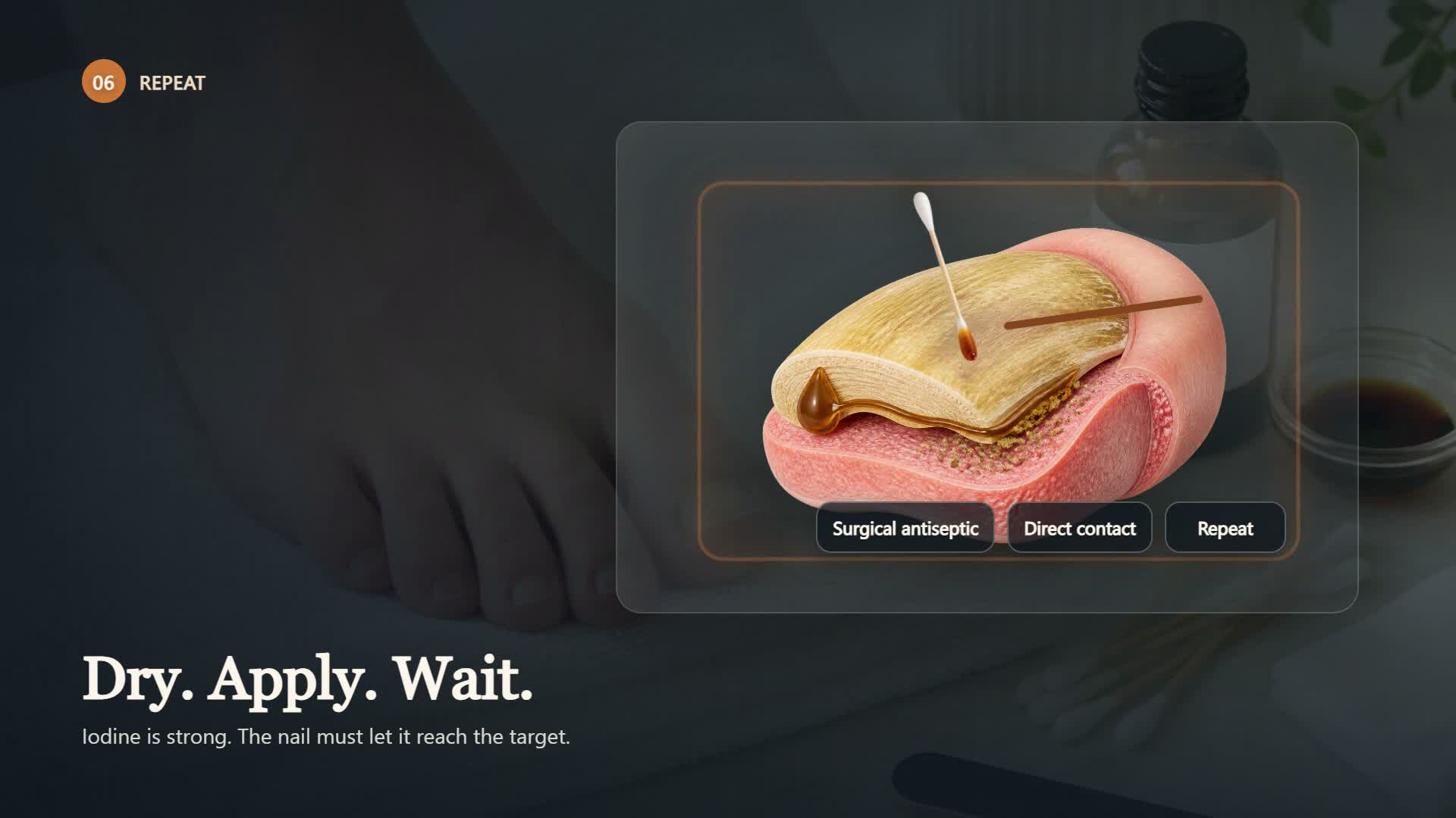Treatment animation showing iodine applied to a thickened toenail