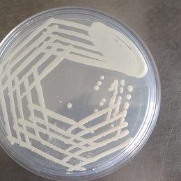 Photograph: Candida albicans colony on Sabouraud dextrose agar, cream-colored, pasty and glistening